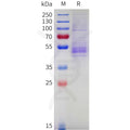 Cynomolgus NKG2A Protein, hFc Tag – Figure 1 of 1