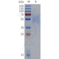 Cynomolgus CD19 Protein, His Tag – Figure 1 of 1