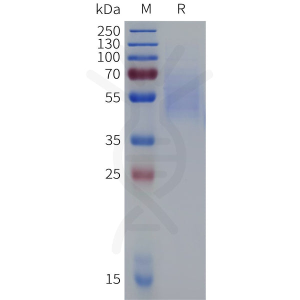 Cynomolgus CD19 Protein, His Tag – Figure 1 of 1