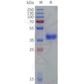 Cynomolgus C5AR1 Protein, hFc Tag – Figure 1 of 1