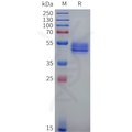 Cynomolgus KLRG1 Protein, hFc Tag – Figure 1 of 1