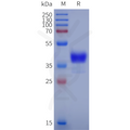 Cynomolgus CCR1 Protein, hFc Tag – Figure 1 of 1
