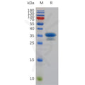 Mouse TweakR Protein, hFc Tag – Figure 1 of 1