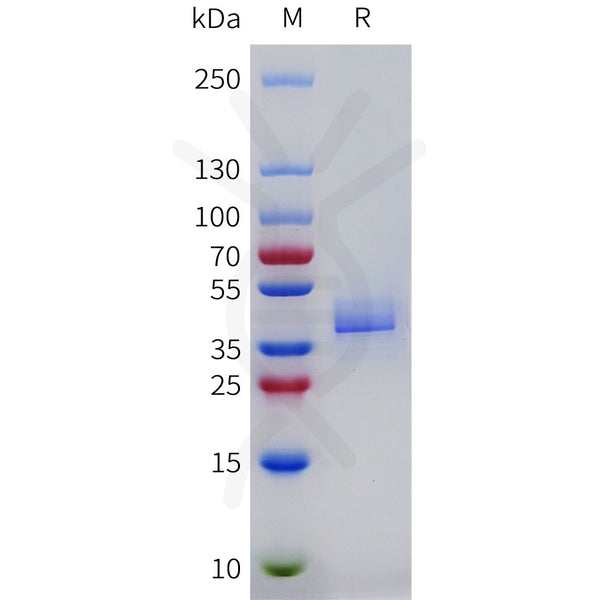 Mouse CXCR2 Protein, hFc Tag – Figure 1 of 1