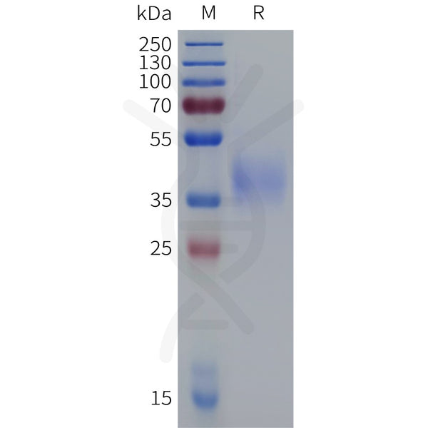 Mouse IL4RA Protein, His Tag – Figure 1 of 1