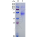 Mouse KLRG1 Protein, hFc Tag – Figure 1 of 1