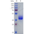 Mouse CXCR1(1-44) Protein, hFc Tag – Figure 1 of 1