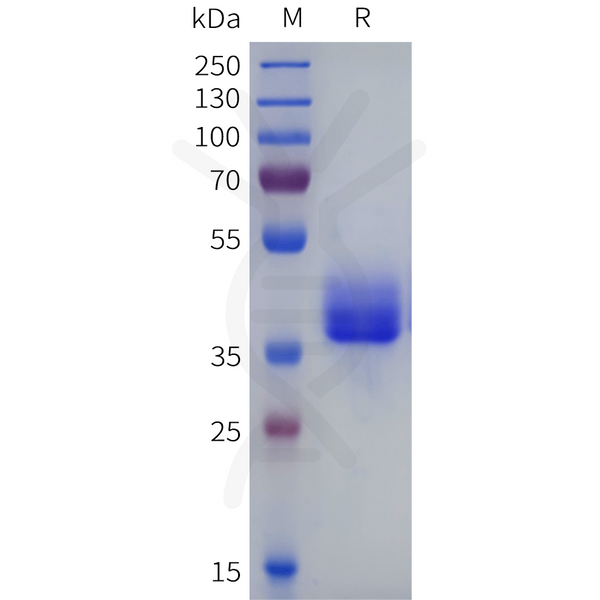 Mouse CXCR1(1-44) Protein, hFc Tag – Figure 1 of 1