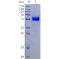 Mouse CD8A Protein, hFc Tag – Figure 1 of 1