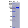 Human CD123 Protein, hFc-His Tag – Figure 1 of 1