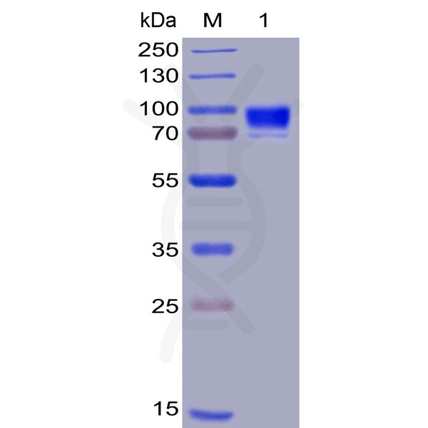 Human CD123 Protein, hFc-His Tag – Figure 1 of 1