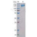Human CD22 Protein, hFc-His Tag – Figure 1 of 1