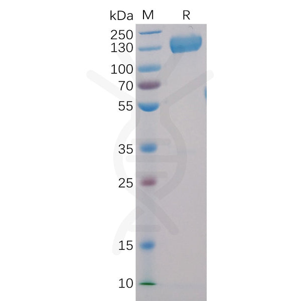 Human CD22 Protein, hFc-His Tag – Figure 1 of 1