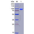 Human CD138 Protein, hFc-His Tag – Figure 1 of 1