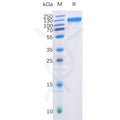 Human FLT3 Protein, hFc-His Tag – Figure 1 of 1