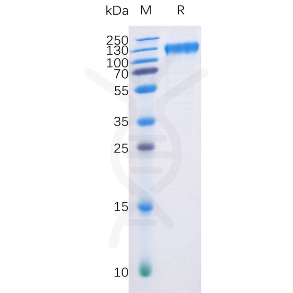 Human FLT3 Protein, hFc-His Tag – Figure 1 of 1