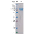 Human 2B4 Protein, mFc-His Tag – Figure 1 of 1