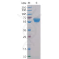 Human 4-1BB Protein, mFc-His Tag – Figure 1 of 1