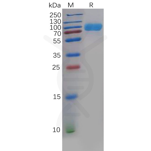 Human B7-H3 Protein, mFc-His Tag – Figure 1 of 1