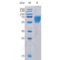 Human CD27 Protein, mFc-His Tag – Figure 1 of 1