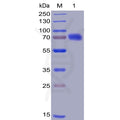 Human CD28 Protein, mFc-His Tag – Figure 1 of 1
