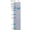 Human CD48 Protein, mFc-His Tag – Figure 1 of 1
