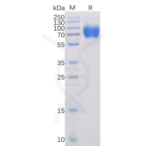 Human SLAMF1 Protein, mFc-His tag – Figure 1 of 1