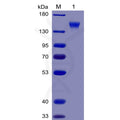 Human CD96 Protein, mFc-His tag – Figure 1 of 1