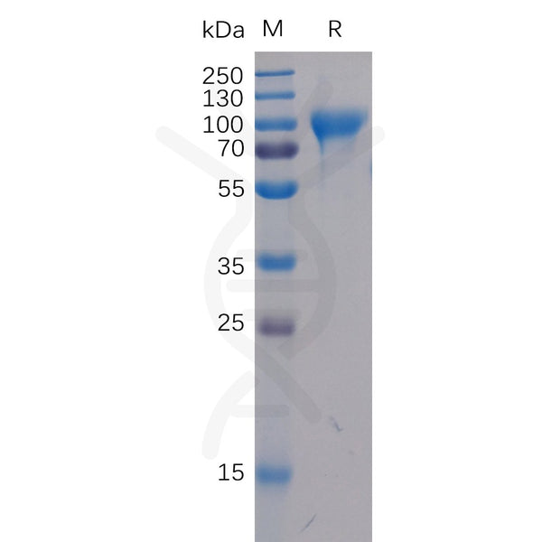 Human B7-H2 Protein, mFc-His Tag – Figure 1 of 1