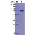 Human TIM3 Protein, mFc-His Tag – Figure 1 of 1
