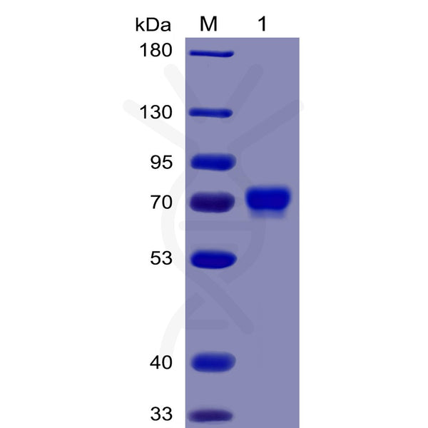 Human Mesothelin (296-580) Protein, mFc-His Tag – Figure 1 of 1