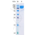 Human B7-2 Protein, mFc-His Tag – Figure 1 of 1