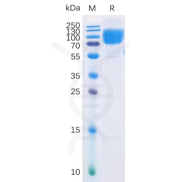 Human B7-2 Protein, mFc-His Tag – Figure 1 of 1