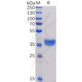 Human BCMA Protein, mFc Tag – Figure 1 of 1