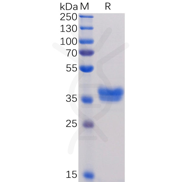 Human BCMA Protein, mFc Tag – Figure 1 of 1