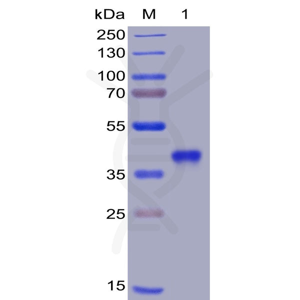 SARS-CoV-2 (2019-nCoV) S protein RBD, His Tag – Figure 1 of 1