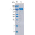 Human CD19 Protein, hFc-His tag – Figure 1 of 1