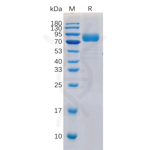 Human CD19 Protein, hFc-His tag – Figure 1 of 1