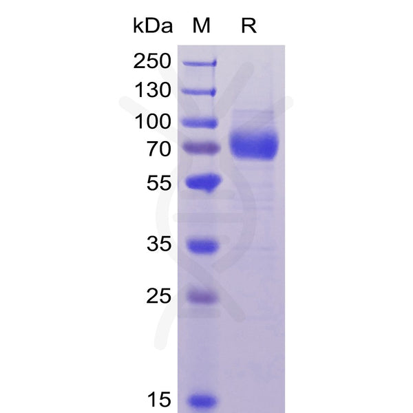 Human CD33(18-259) Protein, hFc-His Tag – Figure 1 of 1