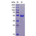 Human CD70 Protein, mFc-His Tag – Figure 1 of 1