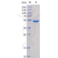 Human BAFF Protein, hFc Tag – Figure 1 of 1