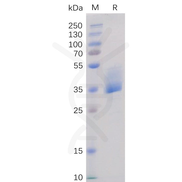 Human BAFF-R Protein, mFc Tag – Figure 1 of 1