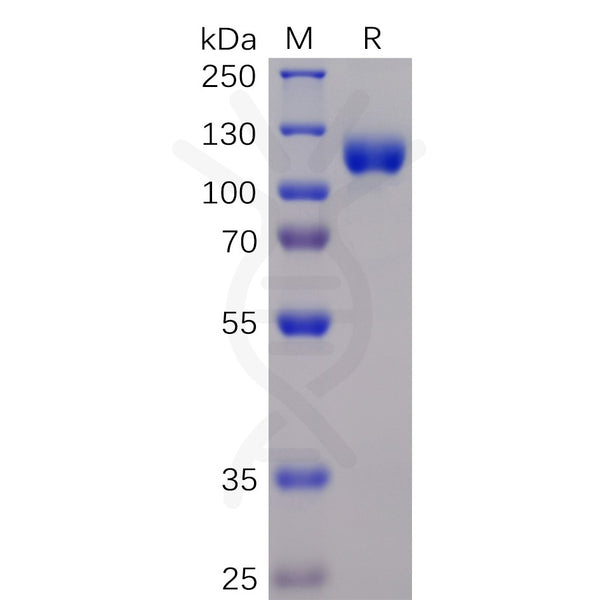 Human EPHA3 Protein, mFc-His Tag – Figure 1 of 1