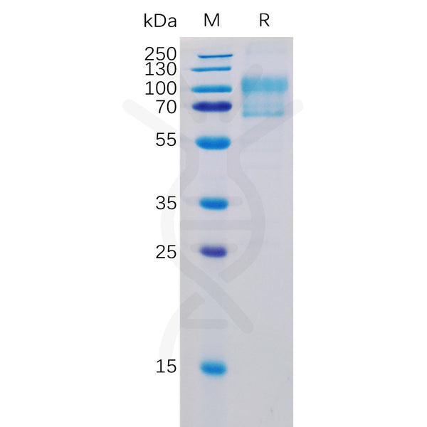 Human B7-1 Protein, mFc-His Tag – Figure 1 of 1