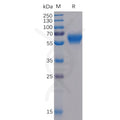 Human BTLA Protein, mFc-His Tag – Figure 1 of 1
