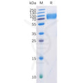 Human DNAM-1 Protein, mFc-His Tag – Figure 1 of 1