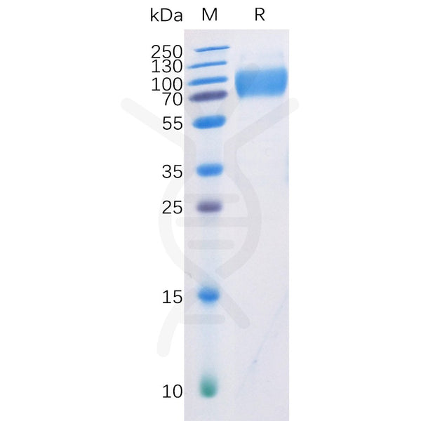 Human DNAM-1 Protein, mFc-His Tag – Figure 1 of 1