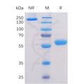 Human BTN3A1 Protein, mFc-His Tag – Figure 1 of 1