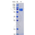 Human SLAMF5 Protein, mFc-His Tag – Figure 1 of 1