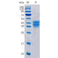 Human CD52 Protein, mFc Tag – Figure 1 of 1